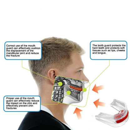 Martial arts Mouth Guard